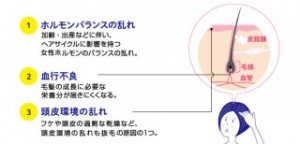 最近よく質問を受けます。抜け毛のこと。
